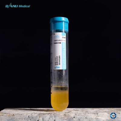 15ml Tabung PRP Menghilangkan Rasa Sakit Tabung Pemisah Gel ACD-A PRP