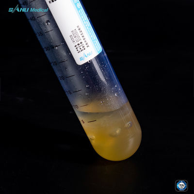 Kurangi Peradangan Platelet Rich Plasma Tube PET 50ml Untuk Perawatan OA